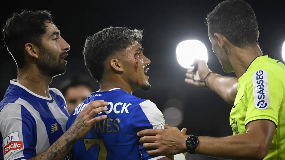 FC Porto's Brazilian forward #07 William Gomes (C) bleeds from a facial wound during the Portuguese League football match between Gil Vicente FC and FC Porto at the Cidade de Barcelos stadium in Barcelos, Portugal on August 18, 2025. (Photo by MIGUEL RIOP
