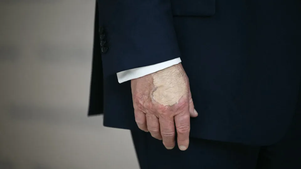Trump, base, mão