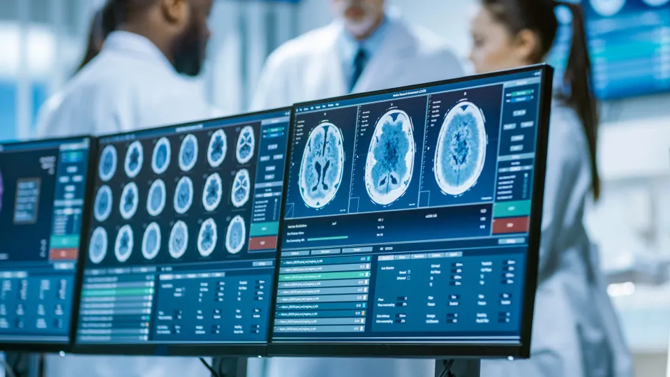 Teste de três minutos pode identificar risco de Alzheimer