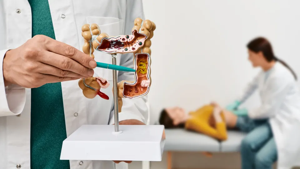 Cinco sintomas de cancro colorretal que podem passar despercebidos
