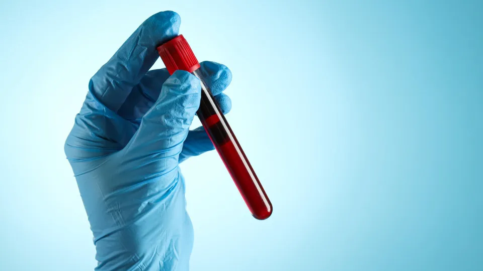 Teste de sangue pode detetar várias doenças 10 anos antes dos sintomas - Notícias ao Minuto