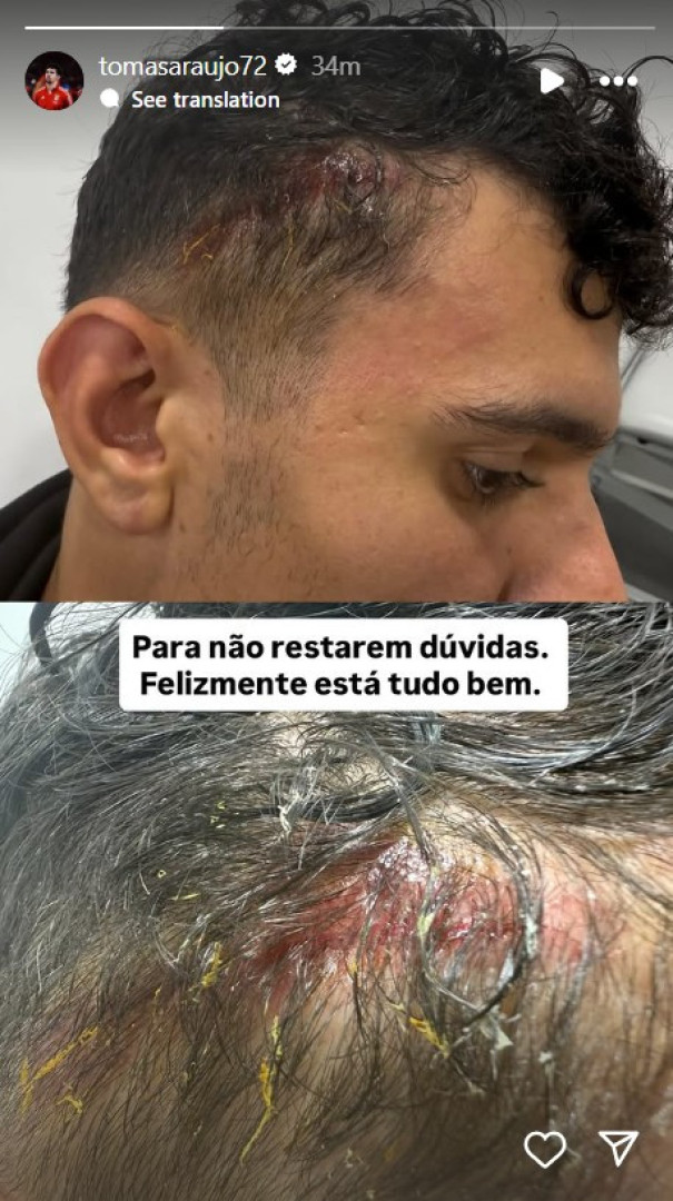 Notícias ao Minuto