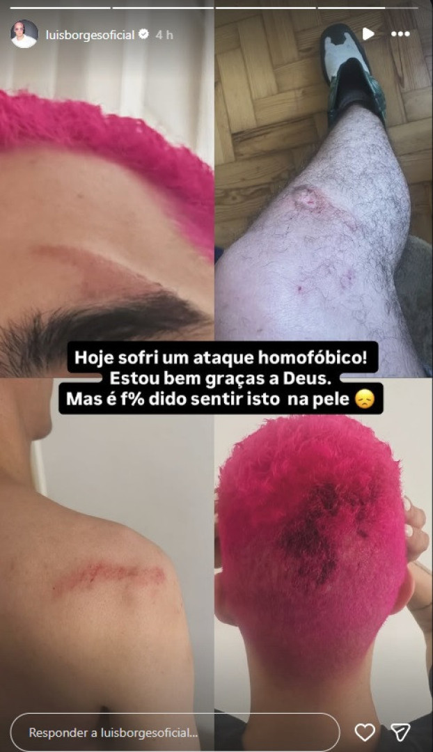Notícias ao Minuto